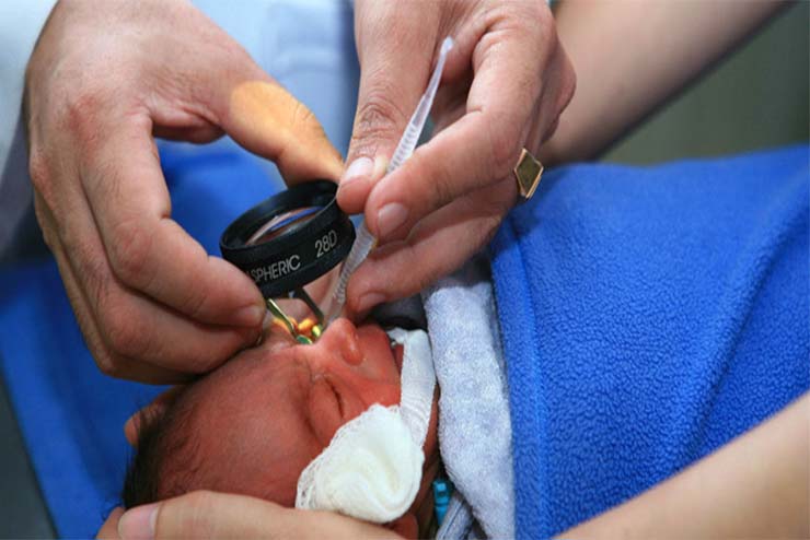 Retinopathy-of-Prematurity